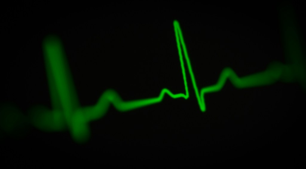 A neon green EKG reading on a black background. 